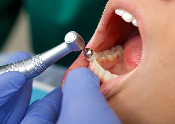 Best Wisdom Tooth Removal  in West End, NY